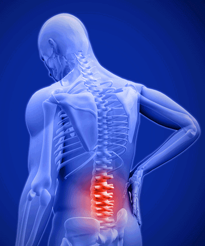 chronic low back pain course man holding lower back