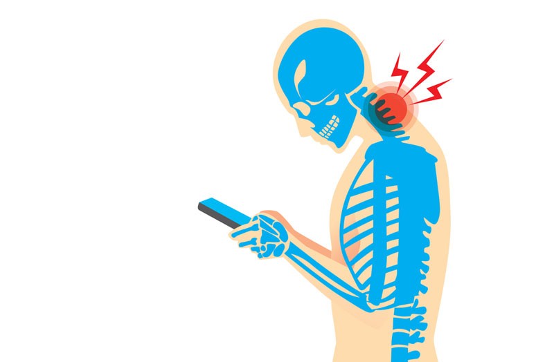 spine image of head tilting downward and bad posture associated with neck pain