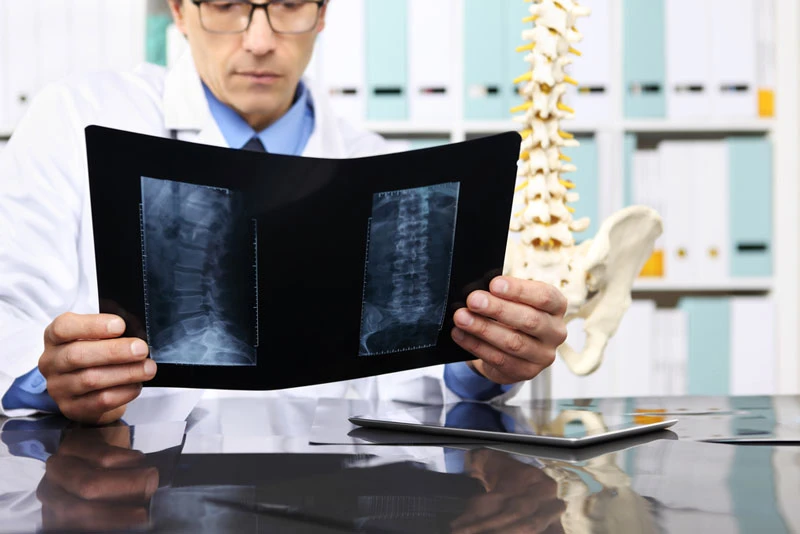 doctor looking at xray of lower back region
